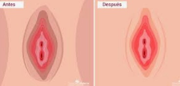 Testimonio RenaceSalud 5